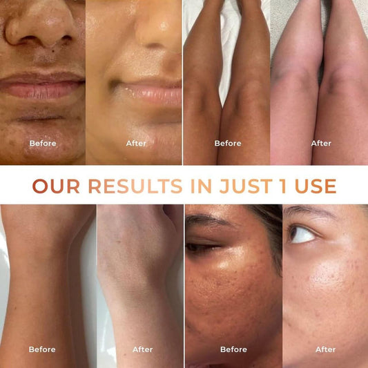 Tan Vanish Gluta Kojic Lotion and Gluta Kojic Serum 100 ml